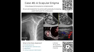 Case 46 A Scapular Enigma [upl. by Tien]