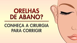 OTOPLASTIA ORELHA DE ABANO COMO É FEITA DREAM PLASTIC  CIRURGIA PLÁSTICA [upl. by Obeng]