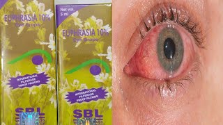 EUPHRASIA EYE DROPS  यूफ्रेसिया आंख का ड्रॉप हिंदी में  EUPHRASIA EYE DROPS IN HINDI [upl. by Eiramik353]