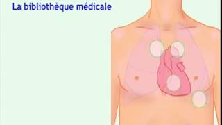 Auscultation cardiaque Bruit cardiaque normal [upl. by Elidad]