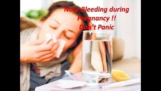 Why nose bleed occurs during Pregnancy How to treat nose bleed [upl. by Nessej151]