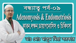 Adenomyosis এবং Endometriosis এর কারনলক্ষনডায়াগনোসিস ও চিকিৎসা [upl. by Lonnie146]