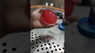 How To Streak For Blood Agar Plates Bacterial Streaking Technique [upl. by Marpet116]