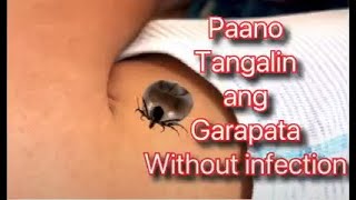 PINAKAMABISANG PARAAN PARA MAWALA ANG GARAPATA SA PALIGID AT SA MGA ASOSUBOK KO NA ITO [upl. by Ayn263]