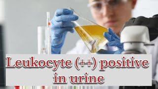 leukocytes positive in urine  symptoms causes  treatment [upl. by Joeann691]