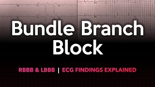 Left and Right Bundle Branch Block ECG Made Easy [upl. by Emiaj]