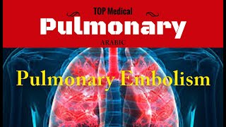 Pulmonary Embolism Arabic [upl. by Erb]