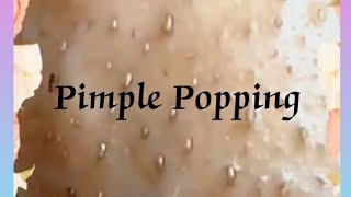 Pimple amp Blackheads Popping 32 [upl. by Boggs829]