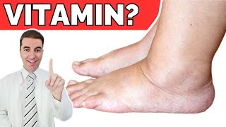 No 1 VITAMIN for removing SWELLING from the body [upl. by Cloots413]