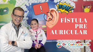 Ayuda mi hijo tiene infección en el oído Fístula Preauricular Hoyelo preauricular infectado [upl. by Niltak]