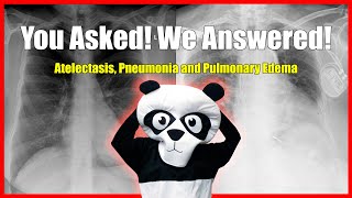 You Asked We Answered  Atelectasis Pneumonia and Pulmonary Edema [upl. by Mota]