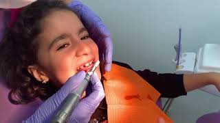 Limpieza Dental Infantil [upl. by Nede]