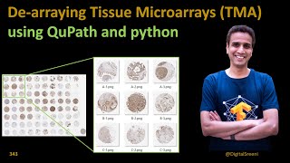 343 Dearraying Tissue Microarrays TMA using Qupath and python code [upl. by Esimaj]