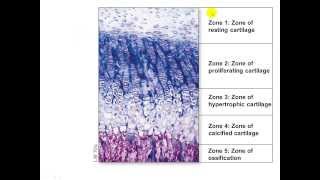 Bone Growth and Remodeling Appositional and Interstitial Growth [upl. by Lemuela339]