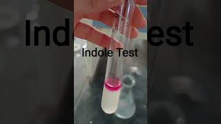 Biochemical test Indole Test Positive [upl. by Ameerak]