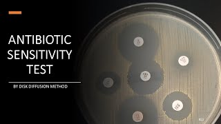 Antibiotic Sensitivity Test by Disc diffusion method Kirby Bauer method amp Stokes method [upl. by Nishi579]