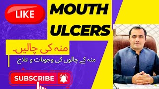 Mouth Ulcers causes investigations treatment and Management [upl. by Mayyahk]