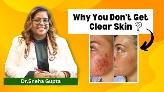 best skin treatments for glowing skin  Get Fully Fair Skin with Dr Sneha Gupta [upl. by Doownel150]