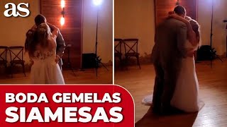 ABBY HENSEL una de las GEMELAS SIAMESAS más famosas se ha casado [upl. by Borek170]