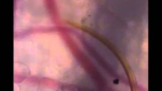 Mosquito finds blood vessel [upl. by Philis]