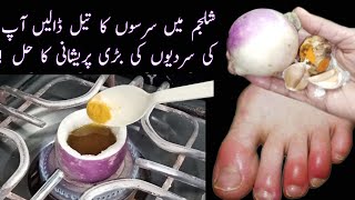 CHILBLAINS Treatment  Home Remedy For Swollen Fingers During Winter [upl. by Gelya305]