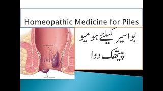 Homeopathic Medicine for Piles  Piles Treatment [upl. by Eicyaj]