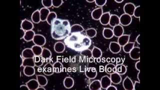 Live Blood Analysis Dark Field Microscopy explained [upl. by Vieva]