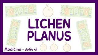 Lichen planus  definition pathophysiology types clinical picture diagnosis amp treatment شرح عربي [upl. by Yentuoc391]