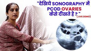 देखिये Sonography में PCOD Ovaries कैसे दीखते है  Dr Asha Gavade [upl. by Alyam]