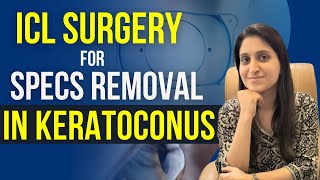 ICL Surgery For Keratoconus [upl. by Backler534]