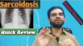 sarcoidosis in urdu hindi  signs amp symptoms investigations treatment [upl. by Nilrac]