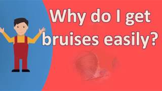 Why do I get bruises easily  Best Health FAQS [upl. by Neelyam]