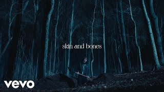 David Kushner  Skin and Bones Official Lyric Video [upl. by Isabea]