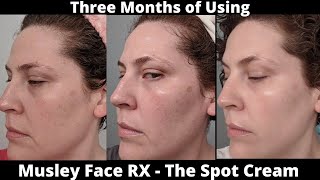 Musely Face RX Review  The Spot Cream [upl. by Ahael]