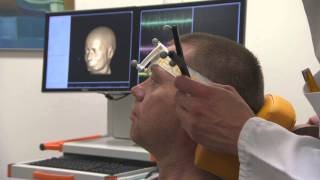 Navigated Brain Stimulation for presurgical mapping and tractography [upl. by Santini]