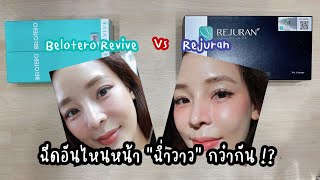 Belotero Revive กับ Rejuran ฉีดอันไหนหน้าฉ่ำวาวกว่ากัน [upl. by Nylodnarb]