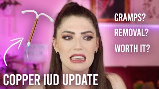 My Copper IUD Experience TWO YEAR UPDATE [upl. by Reagan106]