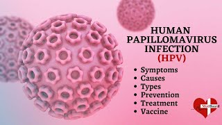 Human papillomavirus infection  HPV  What is HPV amp How do you get it [upl. by Krasner240]