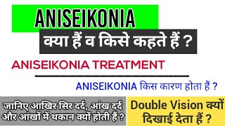 Aniseikonia क्या हैं व किसे कहते हैं  Aniseikonia क्यों होता हैं  Aniseikonia Treatment  in Hindi [upl. by Hopkins496]