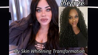 My Extreme Skin Whitening Transformation 2024 [upl. by Yunfei]