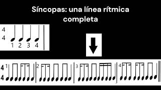 Síncopas Clase III [upl. by Silvio276]