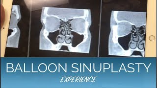 Balloon Sinuplasty Septoplasty and Turbinate Reduction  EXPERIENCE and COST breakdown [upl. by Eldridge797]