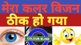 sscgdmedicaltest  colour vision thik kaise karen  ishihara test  colour blindness treatment [upl. by Felice65]