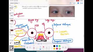 trochlear and abducens nerve palsy ophthalmology 30  First Aid USMLE Step 1 in UrduHindi [upl. by Nyasuh836]