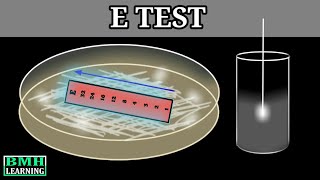 E Test  E Test For Antibiotic Susceptibility  MIC Determination By E Test  Epsilometer Test [upl. by Mccreary575]