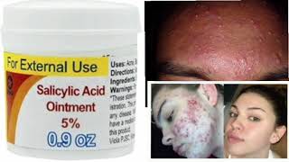 09 OZ Ointment Salicylic Acid Ointment 5 [upl. by Leftwich]