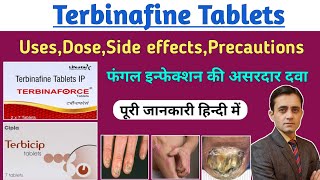 Terbinafine tablets ip 250 mg  Terbinaforce tablet uses dose side effects  फंगल इन्फेक्शन की दवा [upl. by Casimire]