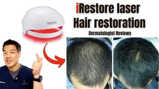 iRestore laser hair restoration Dermatologist Reviews [upl. by Enaamuj]