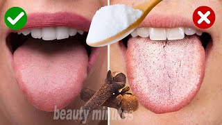 The best natural home remedy to eliminate annoying tongue ulcers as soon as possible [upl. by Ennayelsel385]