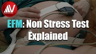 Nonstress Test Explained [upl. by Mortensen86]